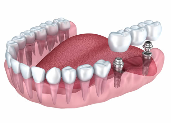 treatblock39